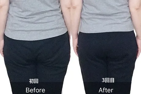骨盤は人体の土台として非常に重要な役割を果たしています。