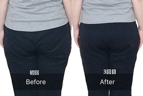 美容整体は、健康的な美しさを追求するための施術として、多くの...