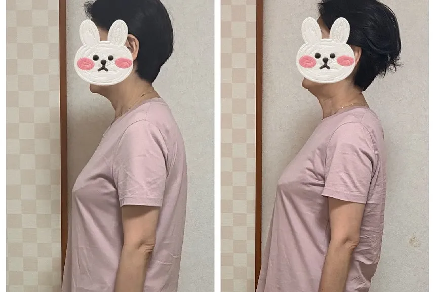 美容整体は、健康的な美しさを追求するための施術として、多くの...