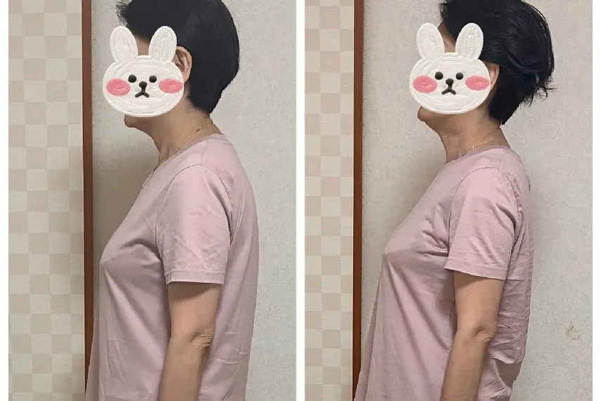 姿勢が悪いと、意外なところで健康に影響を及ぼすことがあります...