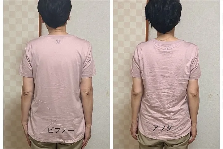 背中の張りや痛みは、日常生活において非常に多くの人が経験する...