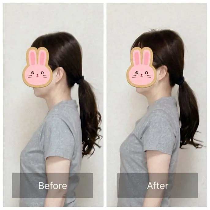 巻き肩を改善するためには、寝る姿勢が非常に重要です🌙。