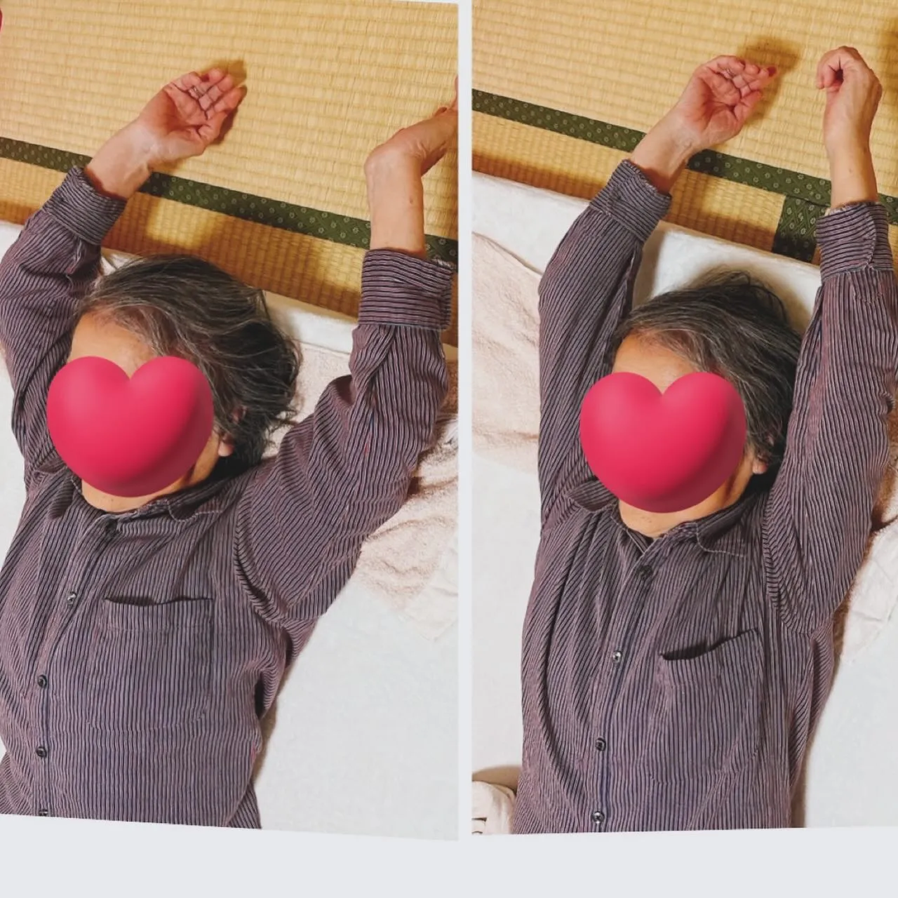 腕が上がらないと、日常生活でさまざまな場面で不便を感じること...