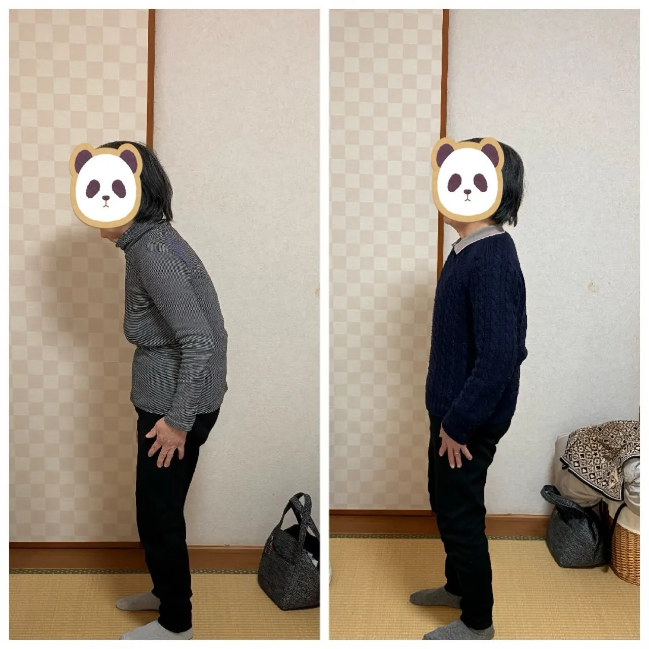 背中や腰が曲がることで、日常生活にさまざまな支障が生じる可能...