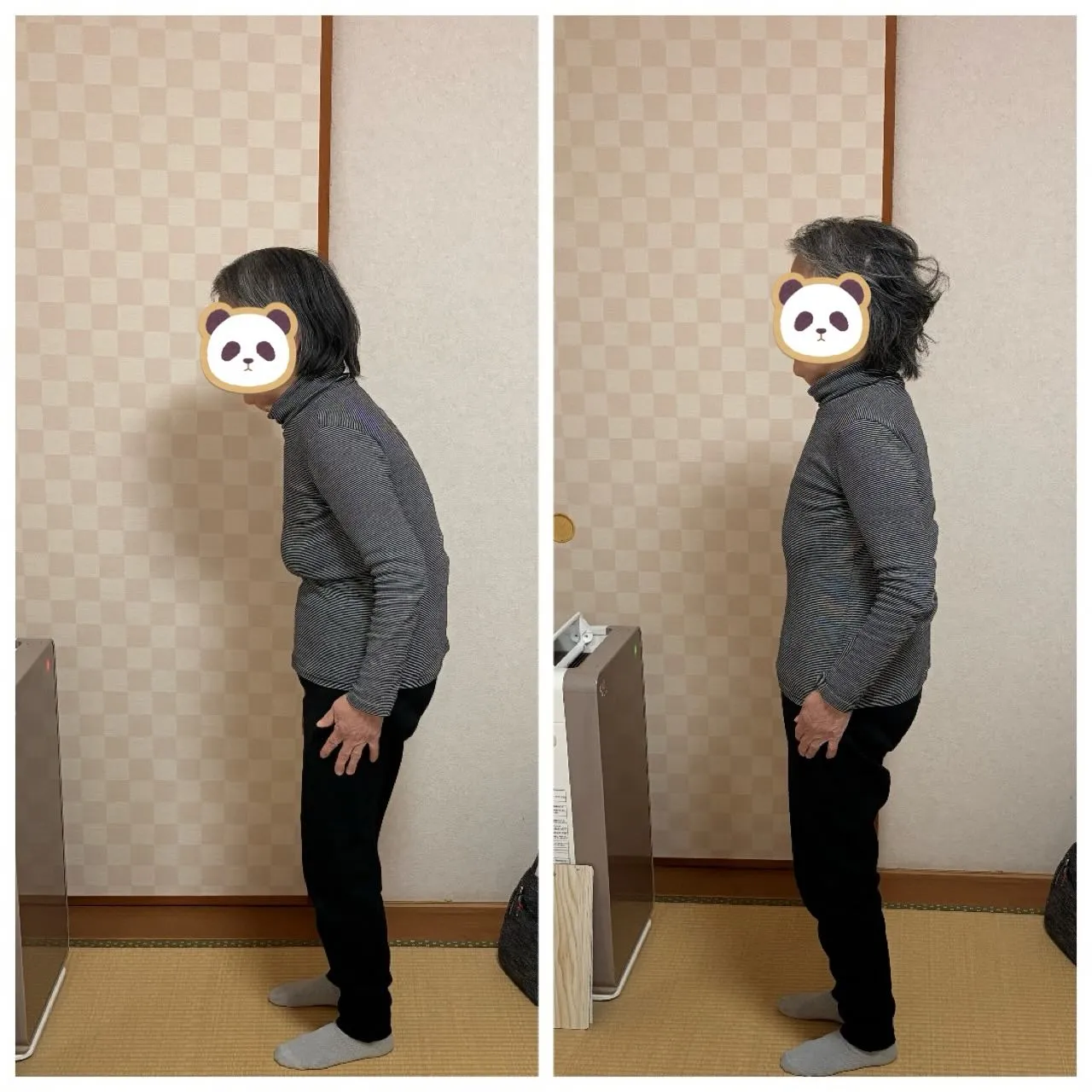 猫背は、一見すると姿勢の問題に留まるように思われがちですが、...